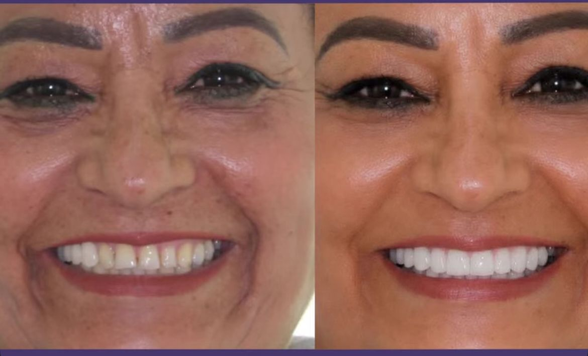 Imagen de diseño de sonrisa proporcionada para la página